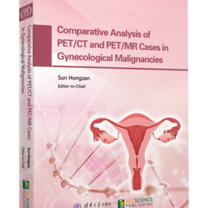 Comparative Analysis of PET/CT and PET/MR Cases in Gynecological Malignancies