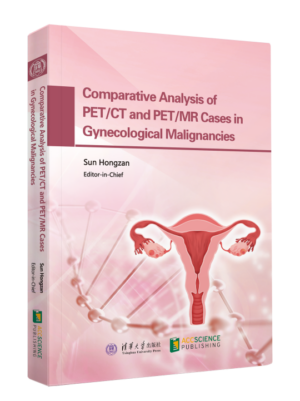 Comparative Analysis of PET/CT and PET/MR Cases in Gynecological Malignancies